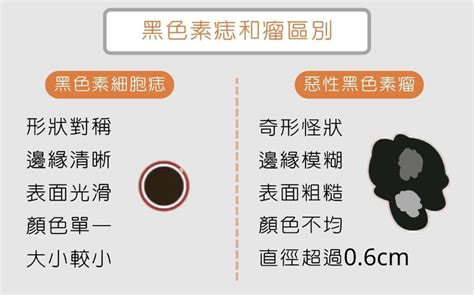 臉上的字|為什麼臉上的痣越來越多？皮膚科醫師解析長痣原因、。